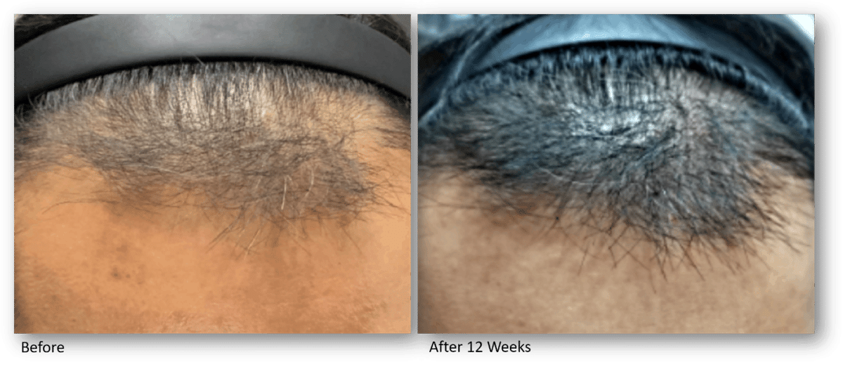 Before and After 2