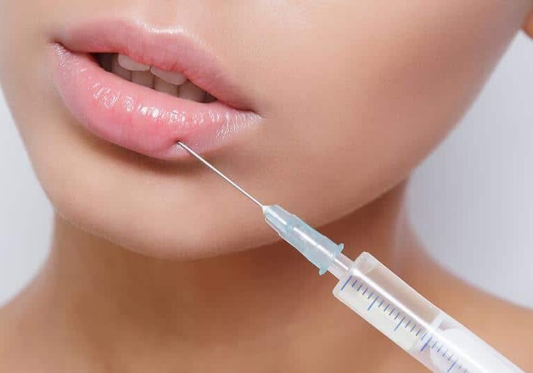 Derma Fillers Peoria AZ